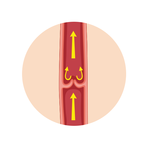 Illustration af veneklapper